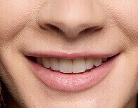 sugar smush lips